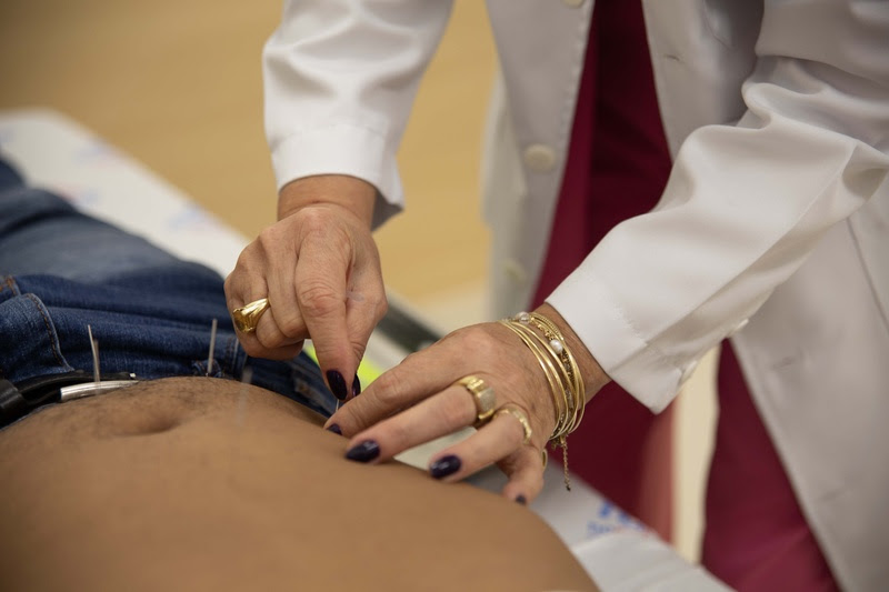 Acupuntura auxilia na reabilitação de pacientes do Hospital de Amor